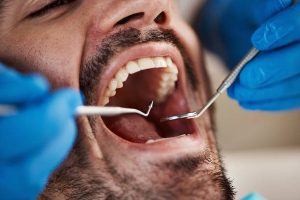 Best Weekend Emergency Dentist in Lexington, MO